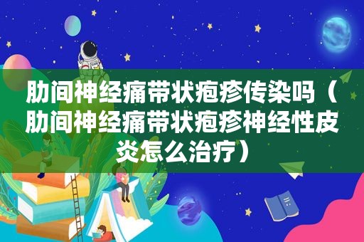 肋间神经痛带状疱疹传染吗（肋间神经痛带状疱疹神经性皮炎怎么治疗）