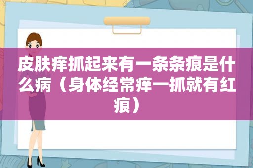 皮肤痒抓起来有一条条痕是什么病（身体经常痒一抓就有红痕）