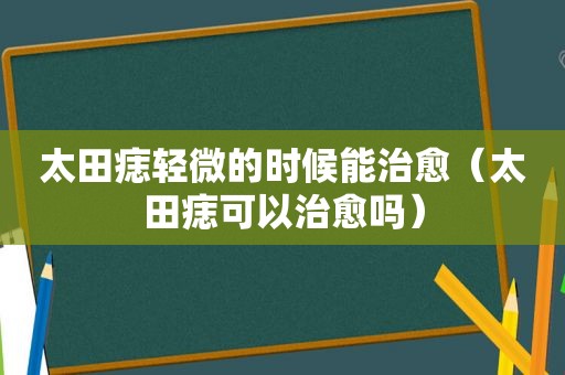 太田痣轻微的时候能治愈（太田痣可以治愈吗）