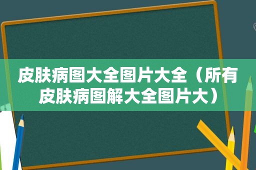 皮肤病图大全图片大全（所有皮肤病图解大全图片大）