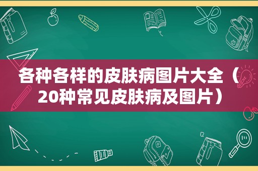 各种各样的皮肤病图片大全（20种常见皮肤病及图片）