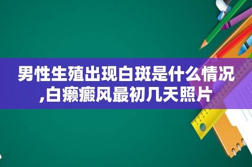 男性生殖出现白斑是什么情况,白癞癜风最初几天照片