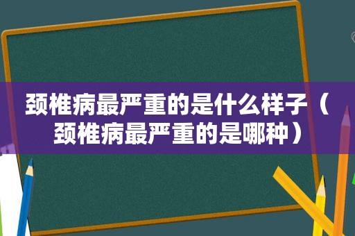 颈椎病最严重的是什么样子（颈椎病最严重的是哪种）