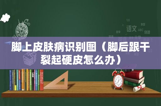 脚上皮肤病识别图（脚后跟干裂起硬皮怎么办）