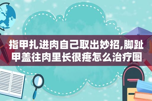 指甲扎进肉自己取出妙招,脚趾甲盖往肉里长很疼怎么治疗图片