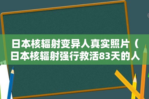 日本核辐射变异人真实照片（日本核辐射强行救活83天的人图片）